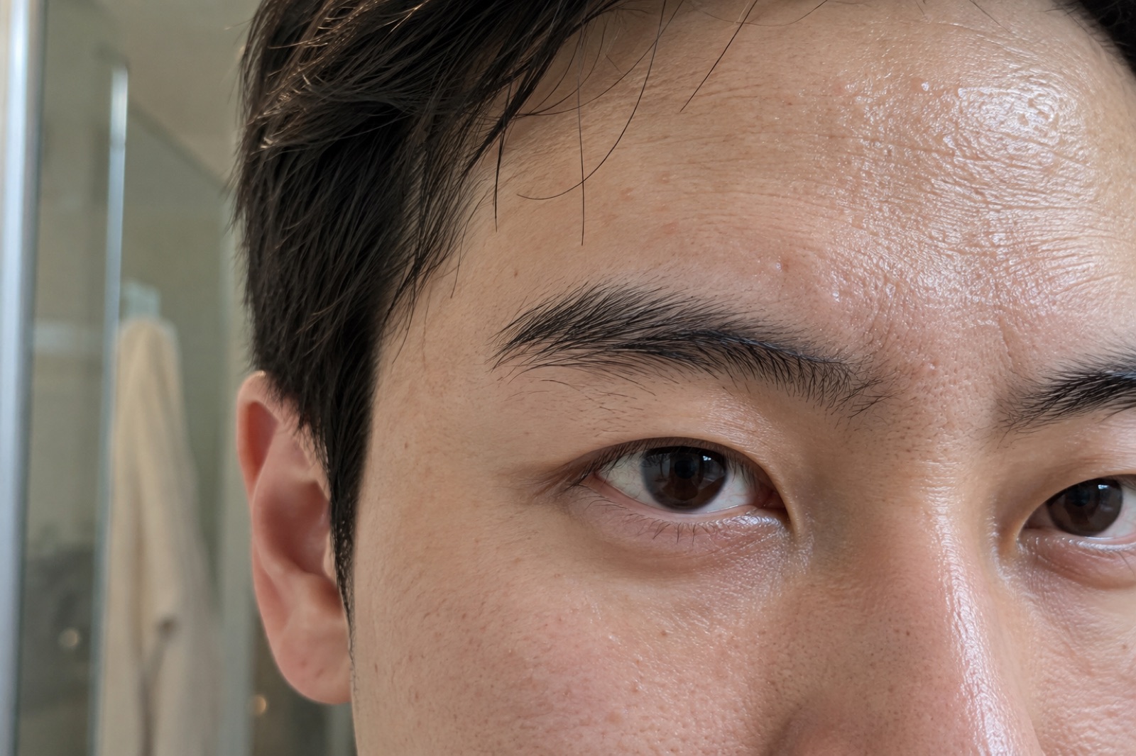 Close-up ng kilay at paligid ng isang mata ng lalaki, may ilang maliliit na umbok sa makintab na noo at kita ang pores sa pisngi