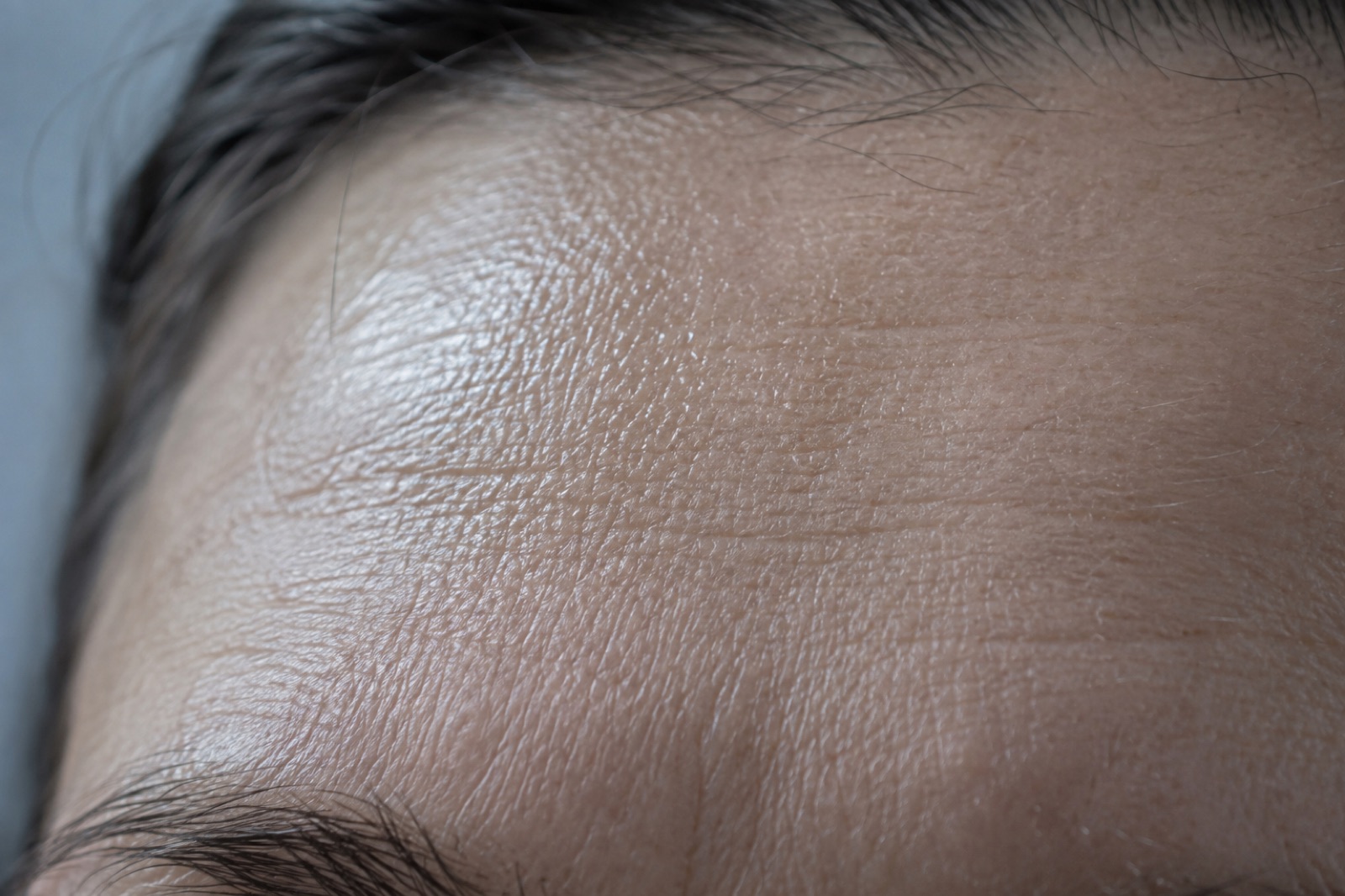Close-up of a forehead between the hairline and eyebrows, shiny on the left and showing fine lines on the right